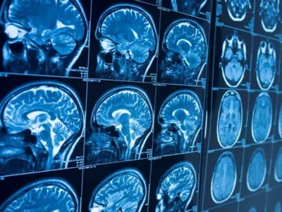 Experts to speak on connection between air pollution and brain health at Pittsburgh event