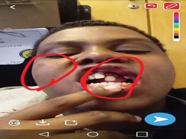 Violent Woodland Hills incidents shed light on the role of law enforcement in schools