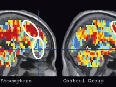 A new study from Pitt and CMU finds that suicidal thoughts may be identifiable using fMRI