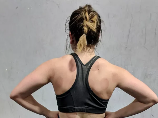 Cupping therapy pulls tension up, like the opposite of massage, but in a soothing way