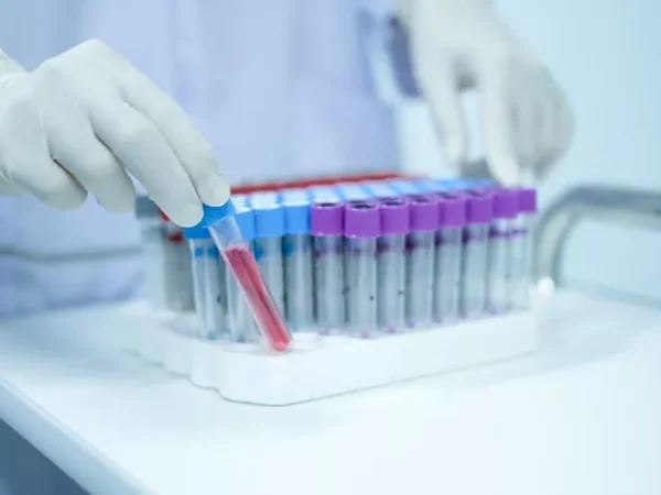 Health department pilots at-home STD testing for young adults